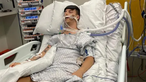 Young man wired up in hospital with a drip in hospital unconscious