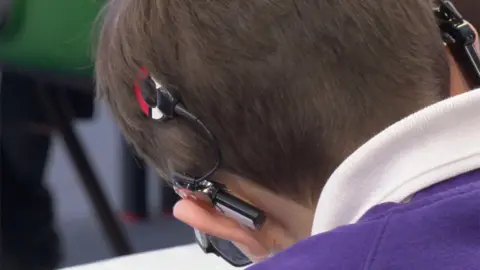 The back of a hearing impaired child's heard.