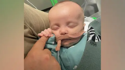 A baby with tubes in his mouth holding an adult's finger