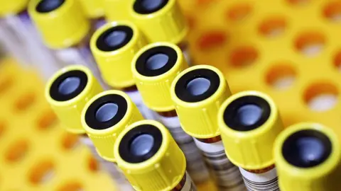 Getty Images Test tubes of donated blood