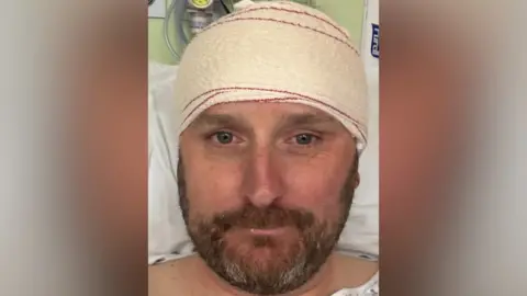 Supplied Mr Whitaker has a beard and is resting in a hospital bed, wearing a gown and a head bandage following a cranial surgery or treatment. Medical equipment is visible in the background.