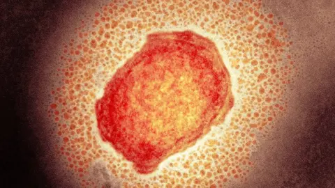 Science Photo Library Monkeypox virus particle