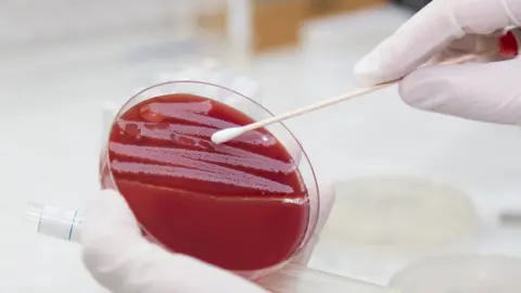 Getty Images Someone in a lab touching bacteria with an ear bud