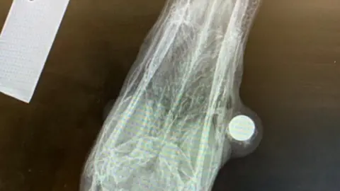 RSPCA X-ray of swan