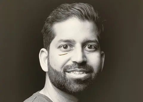 Carol Holliday/Ryan Davies A black and white image of a male patient with a scar underneath his right eye filled in with gold leaf