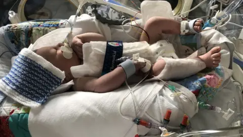 Lauren Mannell Ollie in intensive care