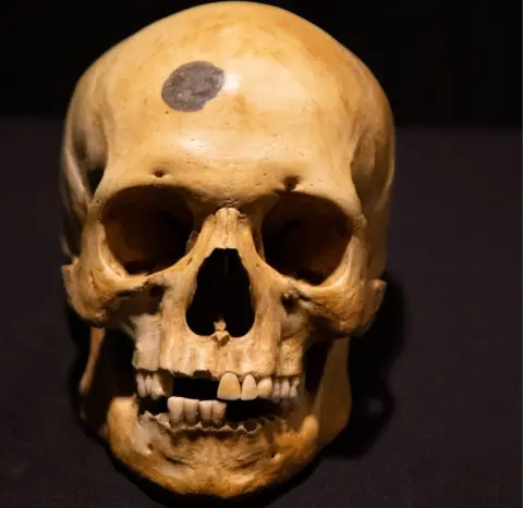 Johnny Black Henry’s actual skull