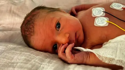 A baby laying on a bed, with hospital hooks on her body.