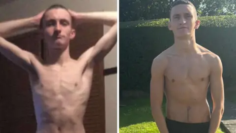 Ethan Humphreys A side-by-side comparison of Ethan. In both he is wearing no top, with his torso exposed. In the left photo, Ethan appears very thin, with ribs prominent. He estimates he weighs about seven stone, or 44 kilos in the image. He is posing with his arms up, and his hands placed on the top of his head. The image is grainy. The image was taken while he was using ketamine. In the second right image, Ethan is looking more muscular, with more defined chest muscles. He estimates he weights 10.5 stone in this image. His hands are by his side, and he is outside, stood on grass with a large hedge in shadow behind him. The image is after going to rehab. In both pictures he has very short cropped black hair and is clean shaven.