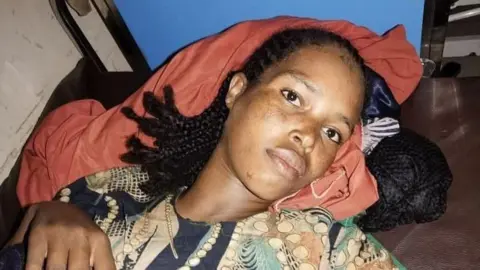 Hiwot Fana Specialised Hospital Close-up of Bedriya lying down. She is wearing a printed green and black top and is resting her head on a red blanket