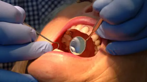 A woman's mouth is being inspected by a dentist. The dentist is wearing blue gloves and holding inspection tools including a mirror over her open mouth.