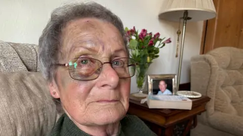 A close-up of an elderly woman looking at the camera. She wears glasses and has bruising around her right eye. She sits in a living room next to a coffee table, which has a photo of a man on it and some flowers in a vase.