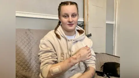 A woman wearing a cream coloured hoody holds up her arm showing injuries