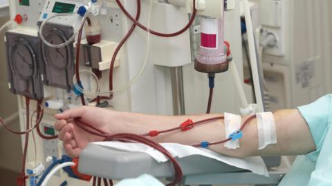 Patient receiving dialysis at hospital