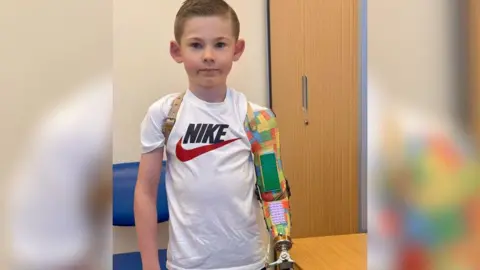 A young boy wearing a white T-shirt, with a prosthetic left arm painted to look like Lego pieces.