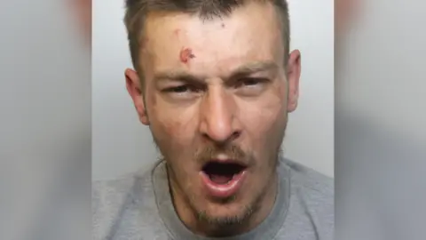 A custody image of Cornish, who is wearing a grey prison-issue sweatshirt. He has his mouth open as if he is shouting at someone, and an angry look on his face. He has short blonde hair and patchy facial hair. There are a number of bruises and cuts to his face. 