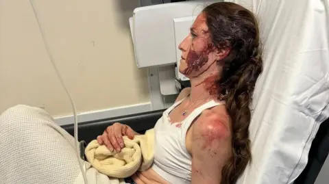 Gemma Hunter Gemma sat in a hospital bed with her knees close to her chest. Her head is covered in dried up blood and she has long dark hair that is tied back.