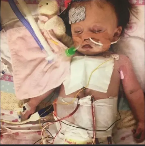 Family photo Elodie as a baby of only a few months old awaiting a transplant, who is in a hospital cot hooked up to lots of wires and tubes.