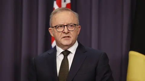 Anthony Albanese in a suit, tie and glasses