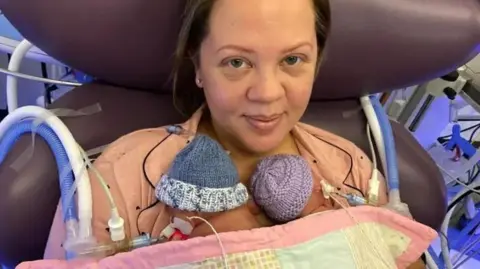 Supplied Jade in a purple chair with two tiny babies on her chest. They have several tubes attached to them. 