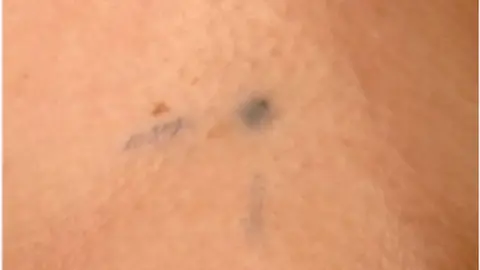 Cancer Research UK A tattoo