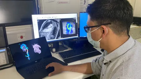 BBC Norfolk and Norwich University Hospital staff with 4D heart scan