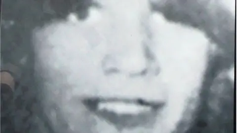 PACEMAKER Seamus Bradley