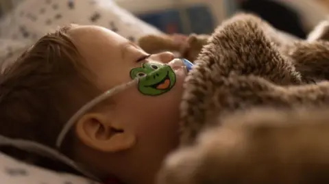 A toddler with brown hair is lying in a bed with a fluffy brown duvet recovering from RSV. He is sleeping and has a blue dummy in his mouth as well as a clear tube going across his face which has a frog sticker on it where his cheek is.