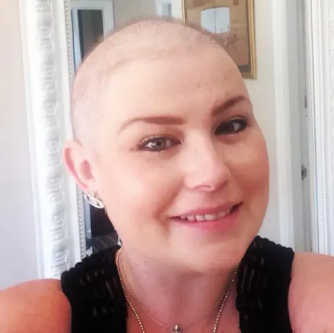 NHS Humber Health Partnership A woman smiling into the camera with brown eyes. She is undergoing cancer treatment and has a shaved head, and is wearing a black top.