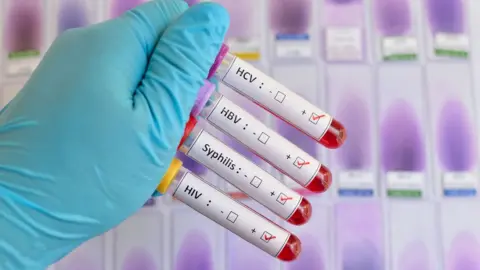 Getty Images A photograph of a person in rubber gloves holding up four tubes containing blood specimens. The containers have labels reading HCV, HBV, Syphillis and HIV