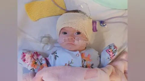 Family handout A young baby, Lila with bandages on her head and a tube through both nostrils. She has her arms out to the side of her body, at shoulder height and is wearing a blue floral baby grow. A soother can be seen near her right shoulder. She is lying on a bed with white sheets.