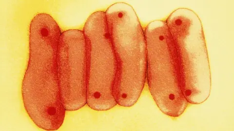 Tuberculosis bacteria