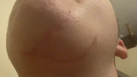 Supplied The underside of Rocco's chin showing a large scar following surgery to repair his chin following his injury.