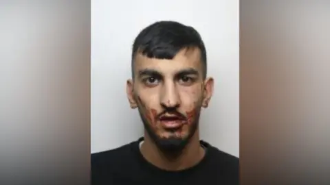 A man in his twenties with short dark hair and blood across his cheeks and chin. 