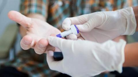 Image of a doctor performing a finger prick test
