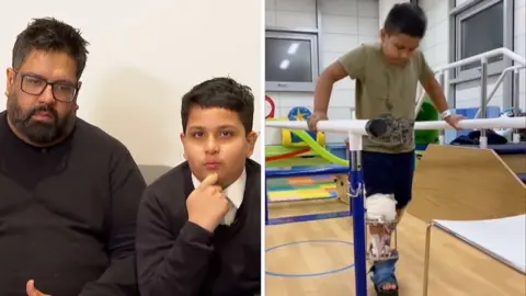 Split screen showing father and son on the left, and boy standing during leg physio session on the right