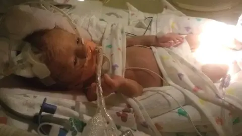 Adam Winch Axle Winch in hospital