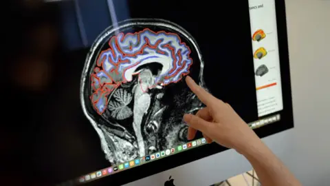 Carmona points at a scan of a cross section of a human brain on a computer monitor, different areas of grey matter are outlined in red and blue.