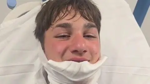 A close-up selfie-style image of Rocco Kirkpatrick with a white bandage on his chin. He is lying in what appears to be a hospital bed. 