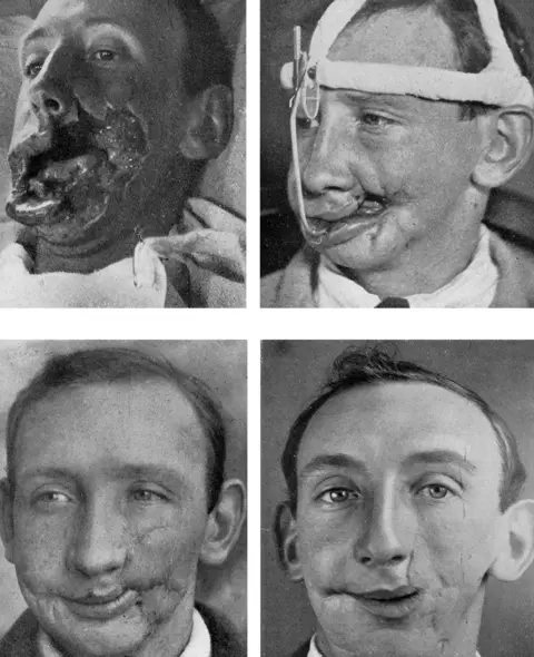 Getty Images Facial reconstructions