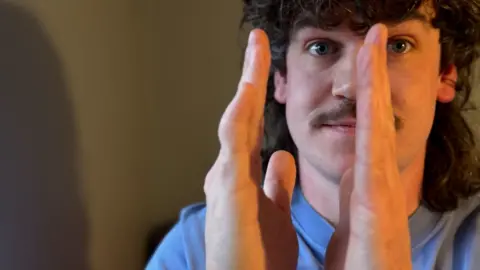 Stephen is holding his hands up in front of his face to show how the injury has affected his finger. His palms are facing each other about 3 inches apart. The little finger on his right hand is considerably shorter than the one on his left hand. It is also bent outwards. 