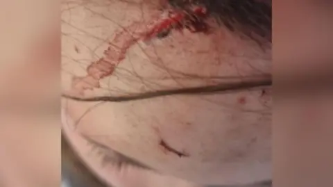 Tia-Trance Cooper A shot of a woman's head from above. It shows two knife injuries on her forehead, one of which has dried blood coming from the wound.