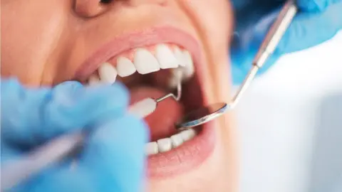 Getty/Bojan89 Open female mouth during oral checkup at the dentist. Selective - stock photo