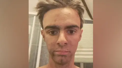 A selfie style image of a young man with dirt all over his face. 