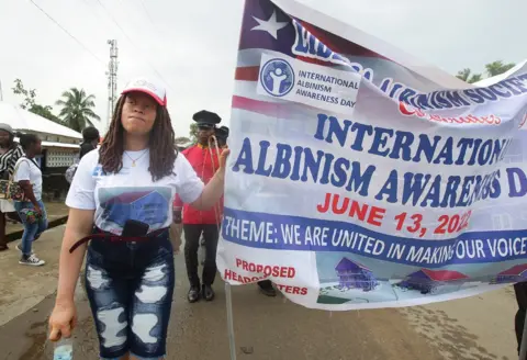 EPA People with albinism take part in a parade in Monrovia, Liberia, on 13 June 2022.