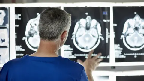 Getty Images Doctor looking at X-rays