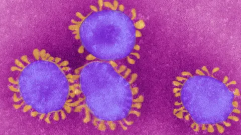 Getty Images Coronaviruses under the microscope