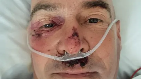 Paul Hughes Paul Hughes in hospital 