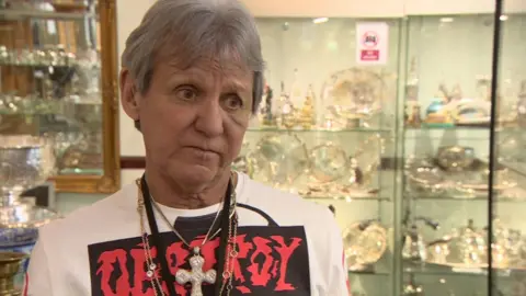 BBC Ian Towning in his arcade with a bruise under his eye