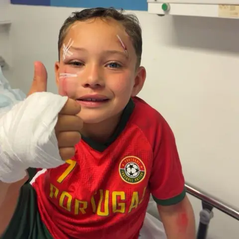 Trionagh Hunte A boy sitting on a hospital bed wearing a red Portugal football jersey. He has cuts and bruises on his face some taped up and has his thumb up to the camera - it is also bandaged.